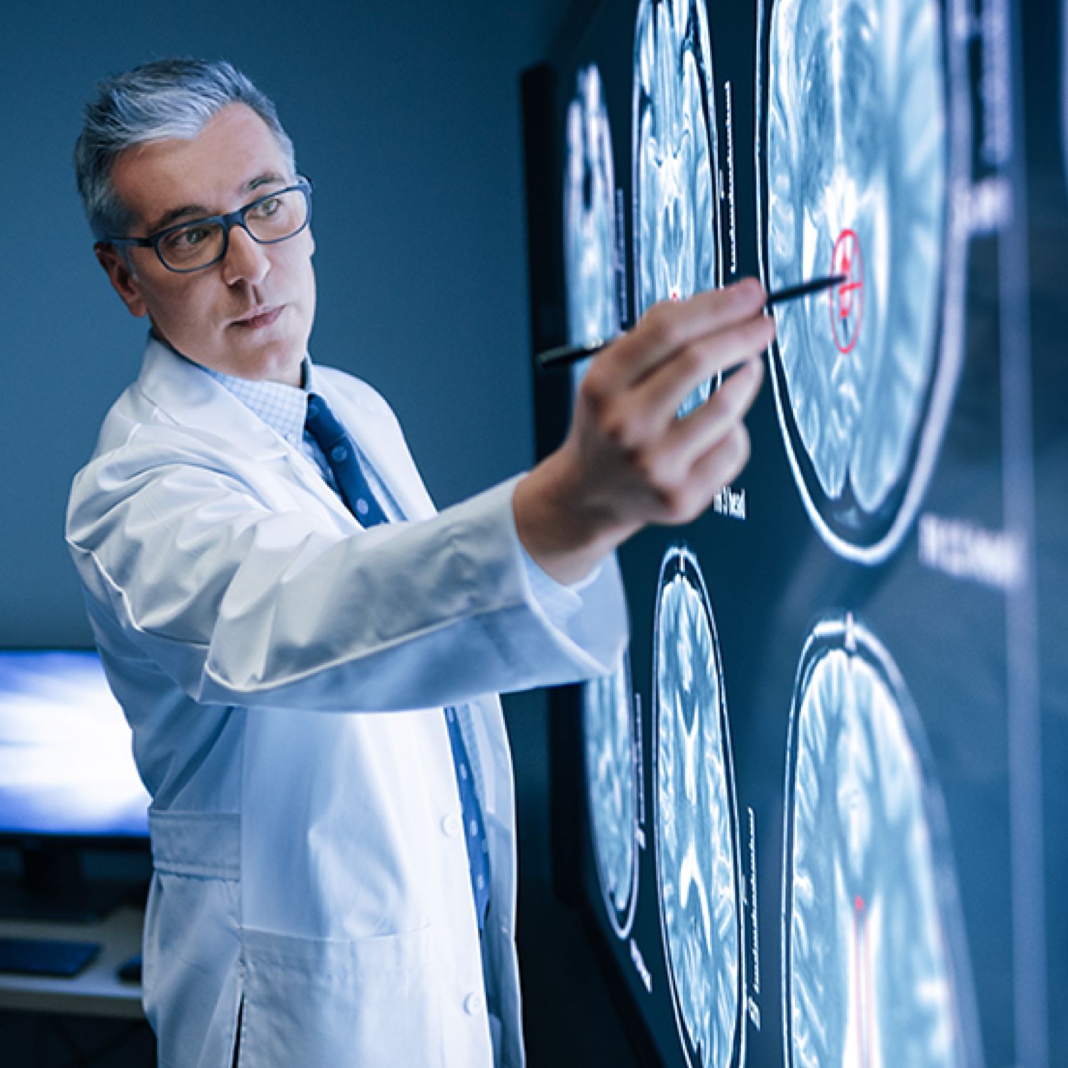 diagnostic AI